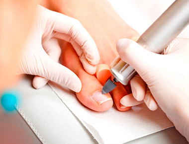 Это комплекс медицинских и профилактических мер, направленных на диагностику и лечение заболеваний стоп и ногтей на пальцах ног. К таким услугам относятся лечение вросших ногтей, грибка, мозолей, трещин, а также проведение медицинского педикюра и коррекция деформаций стопы. От 15000 тг.